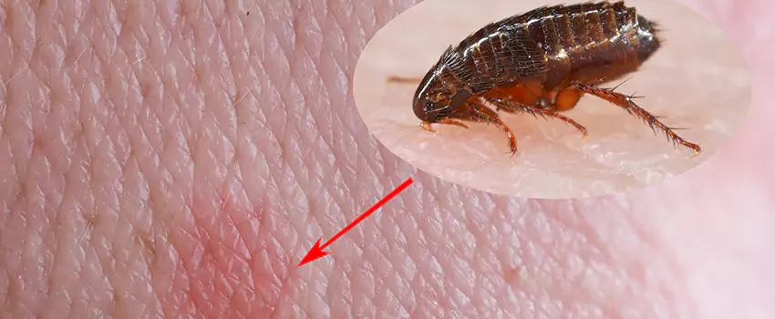 Flea Control for Humans Little Elm, TX